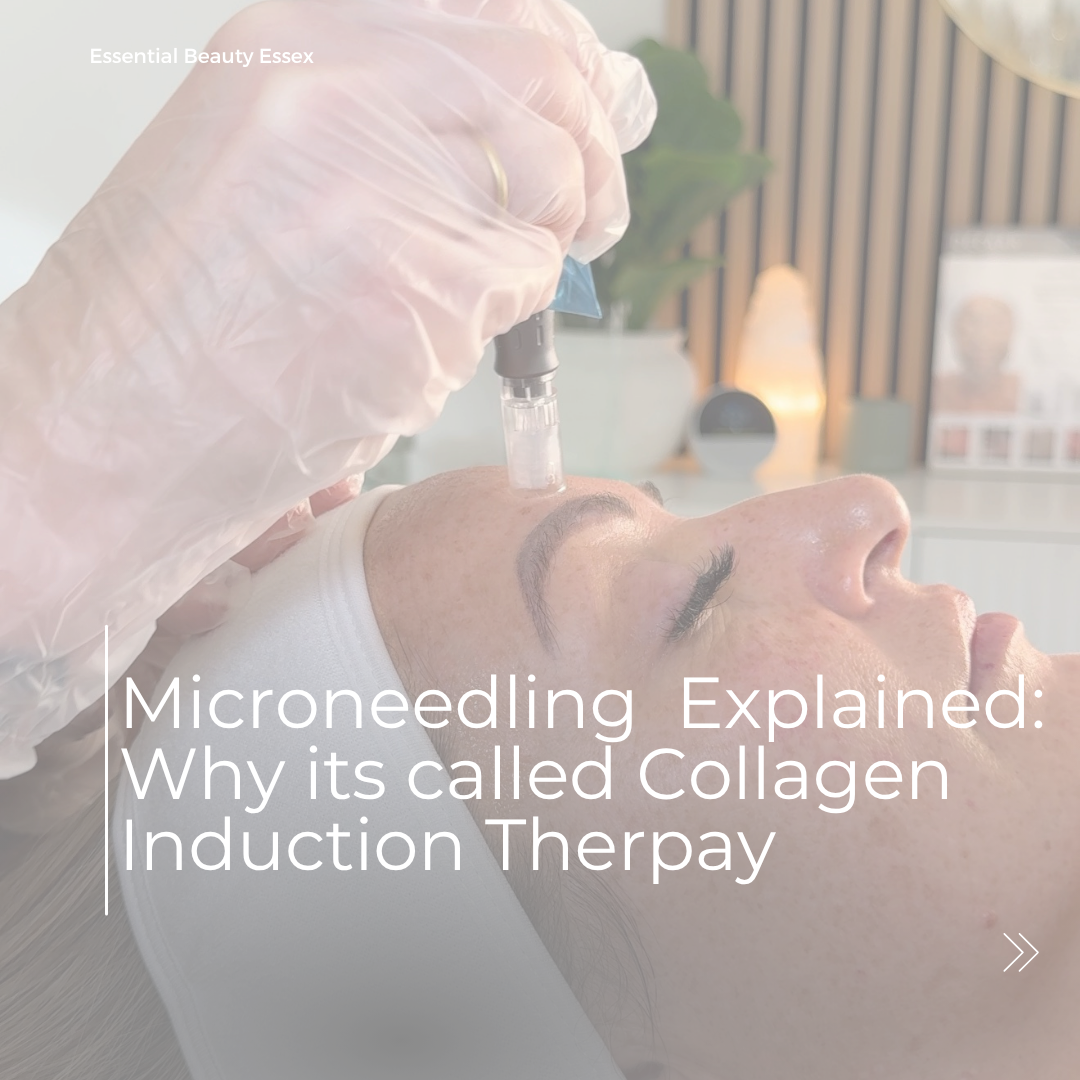 MICRONEEDLING EXPLAINED: WHY IT’S CALLED COLLAGEN INDUCTION THERAPY