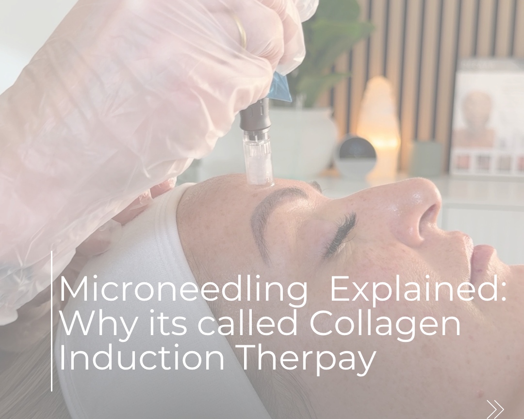 MICRONEEDLING EXPLAINED: WHY IT’S CALLED COLLAGEN INDUCTION THERAPY