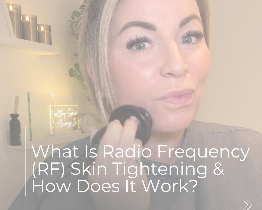 What Is Radio Frequency (RF) Skin Tightening &amp; How Does It Work?