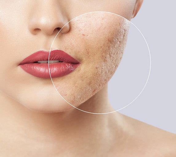 Collagen Lift for Fine Lines, Wrinkles, Sagging Skin, Age Spots and Pigmentation