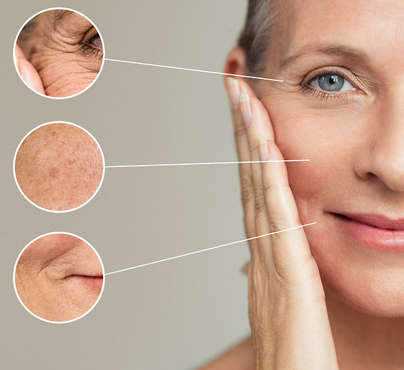 Collagen Lift for Fine Lines, Wrinkles, Sagging Skin, Age Spots and Pigmentation